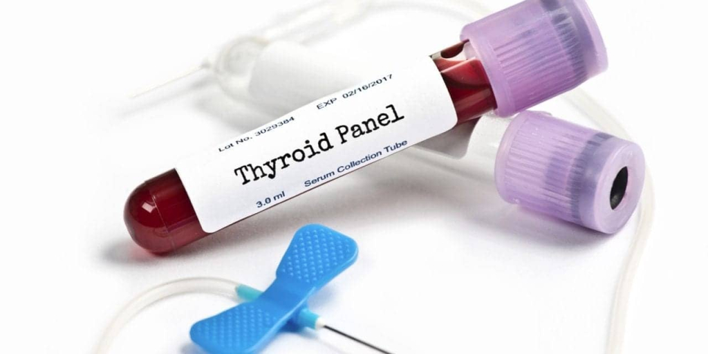 Dreamstime-Thyroid-panel-blood-collection-set_xxl_66837470_crop1280x751p-1280x640